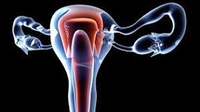 foro resultados biopsia endometrial