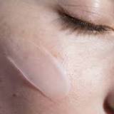Cremas y Reacciones Alérgicas en la Cara