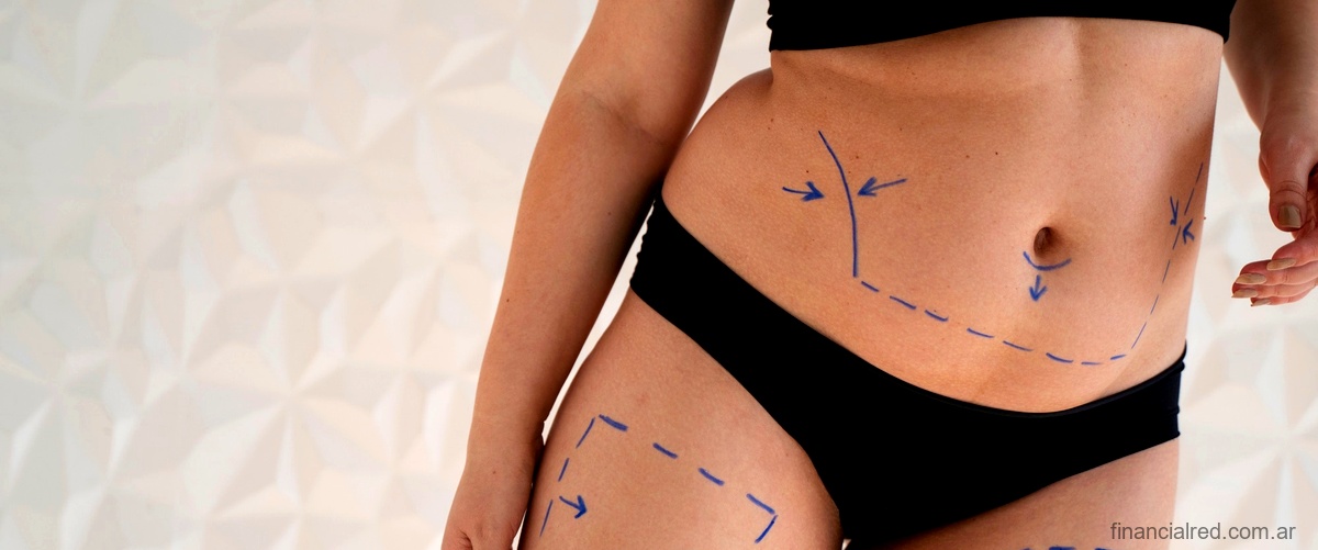 Tatuaje para abdominoplastia: Embellece tu cicatriz con estilo